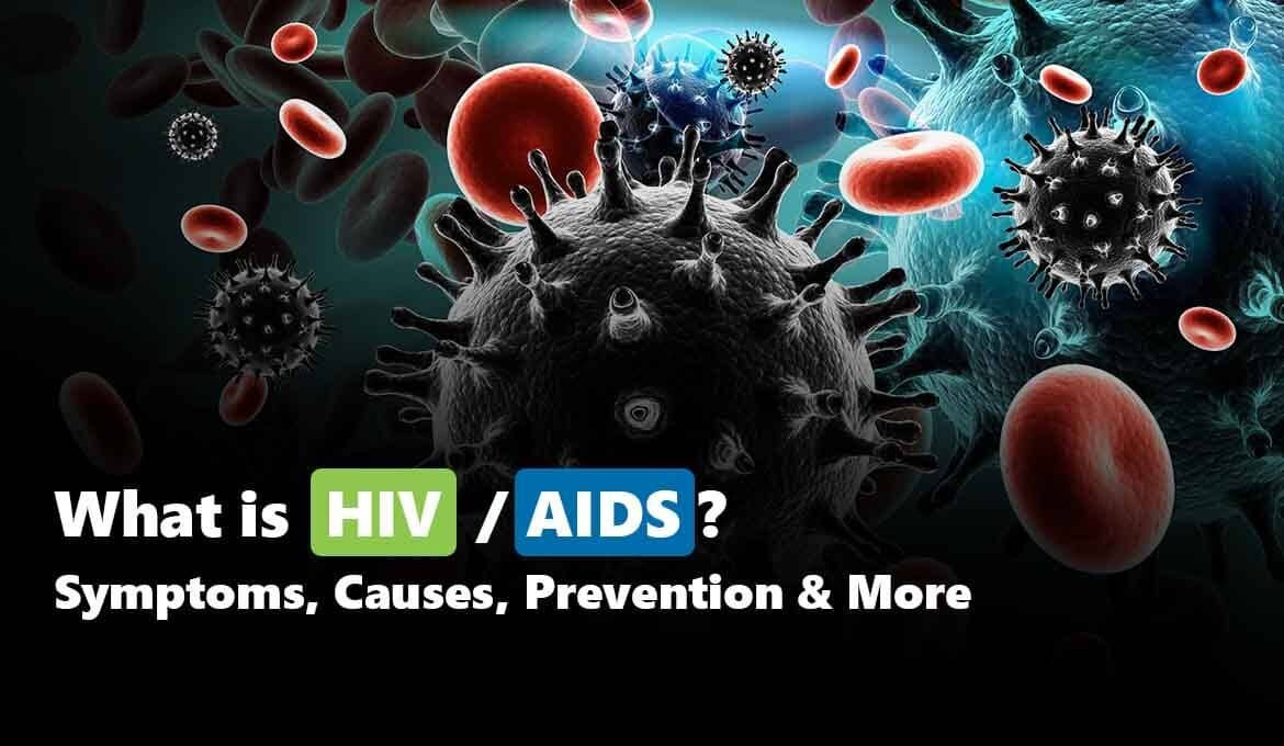 HIV AIDS